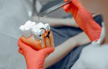 Cosmetic fillings
