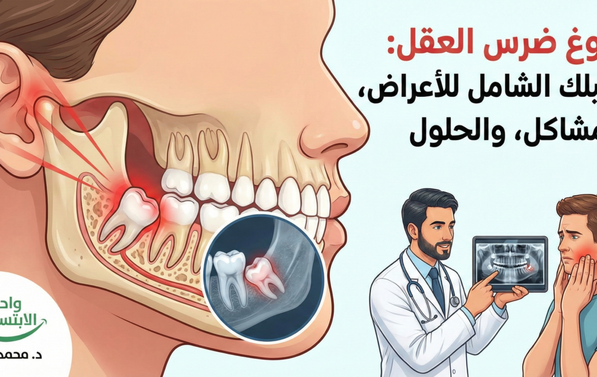 بزوغ ضرس العقل: دليلك الشامل للأعراض، المشاكل، والحلول