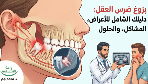 بزوغ ضرس العقل: دليلك الشامل للأعراض، المشاكل، والحلول